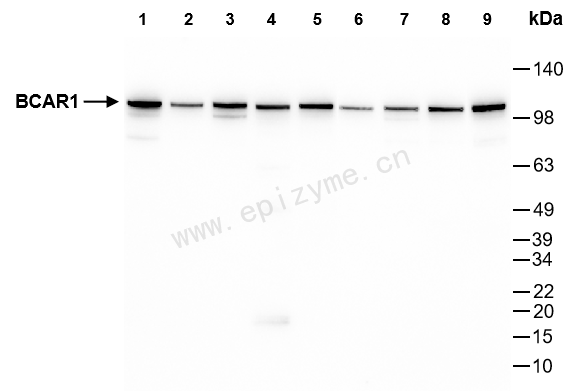 Anti-BCAR1 Rabbit mAb [28L05A78]
