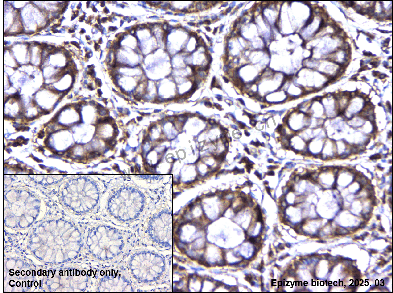 Anti-BCAR1 Rabbit mAb [28L05A78]