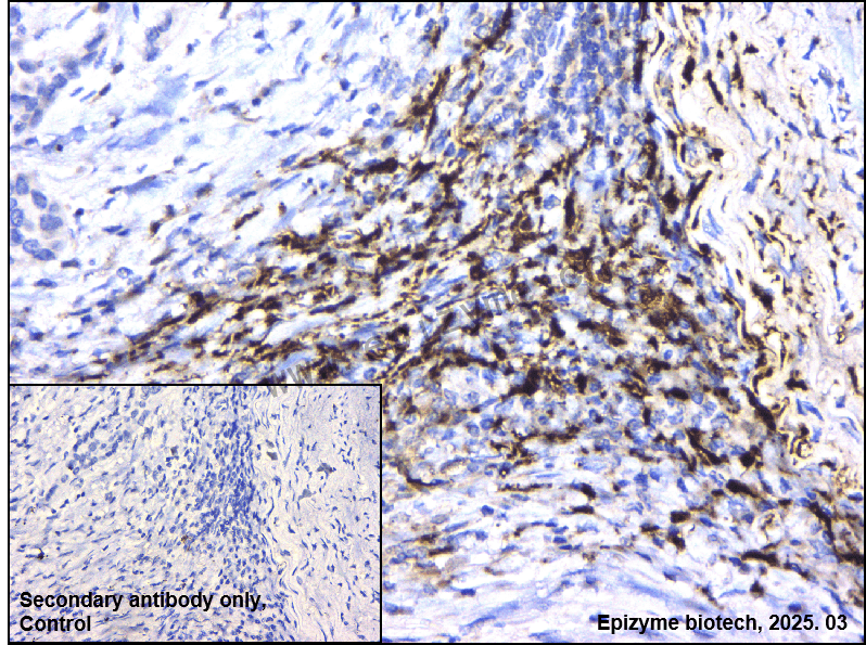 Anti-Fibrinogen alpha chain Rabbit mAb [68H05F31]