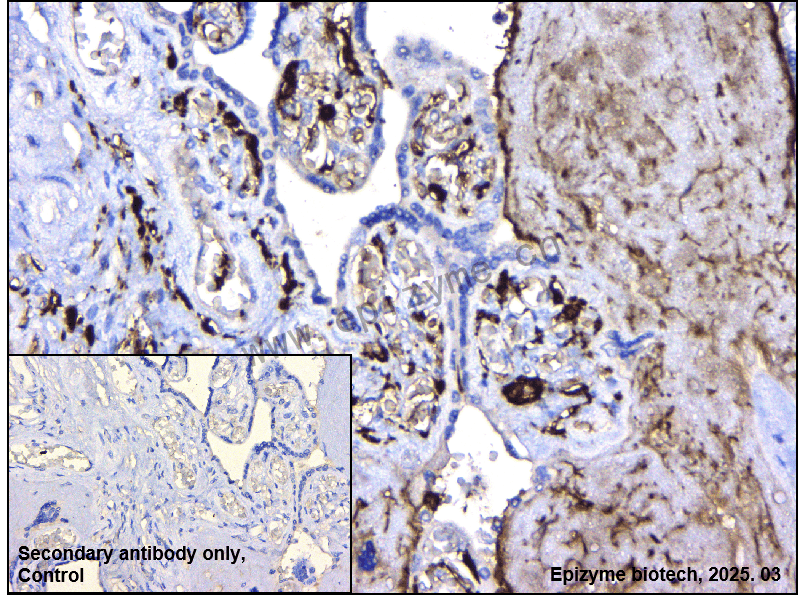 Anti-Fibrinogen alpha chain Rabbit mAb [68H05F31]