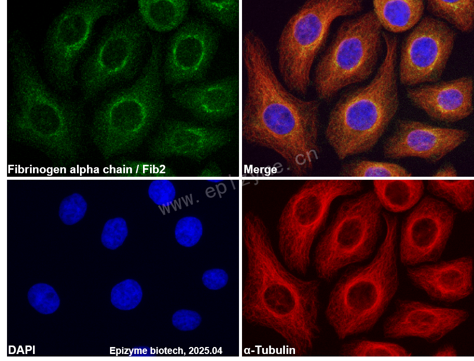 Anti-Fibrinogen alpha chain Rabbit mAb [68H05F31]