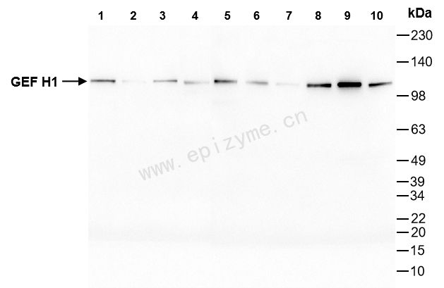 Anti-GEF H1 Rabbit mAb [47L11M49]
