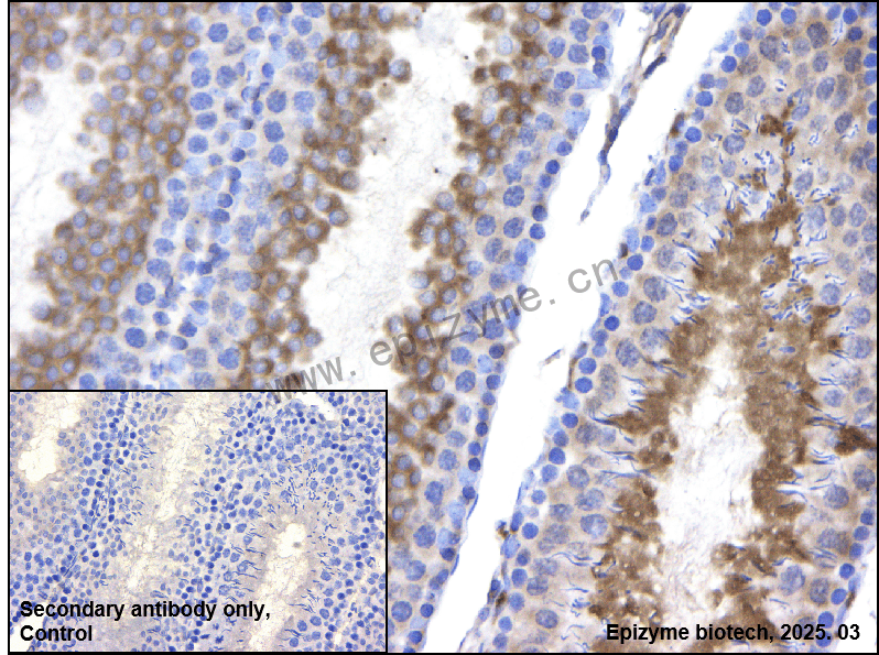 Anti-GEF H1 Rabbit mAb [47L11M49]