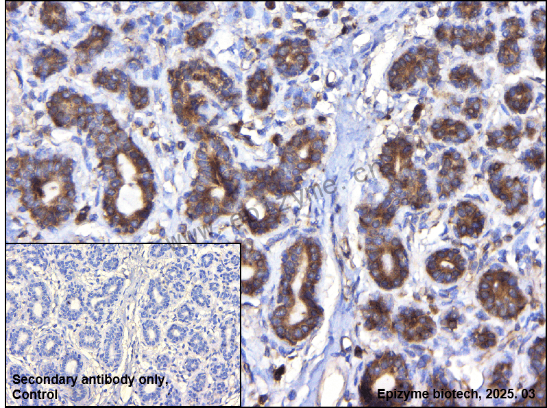 Anti-GEF H1 Rabbit mAb [47L11M49]