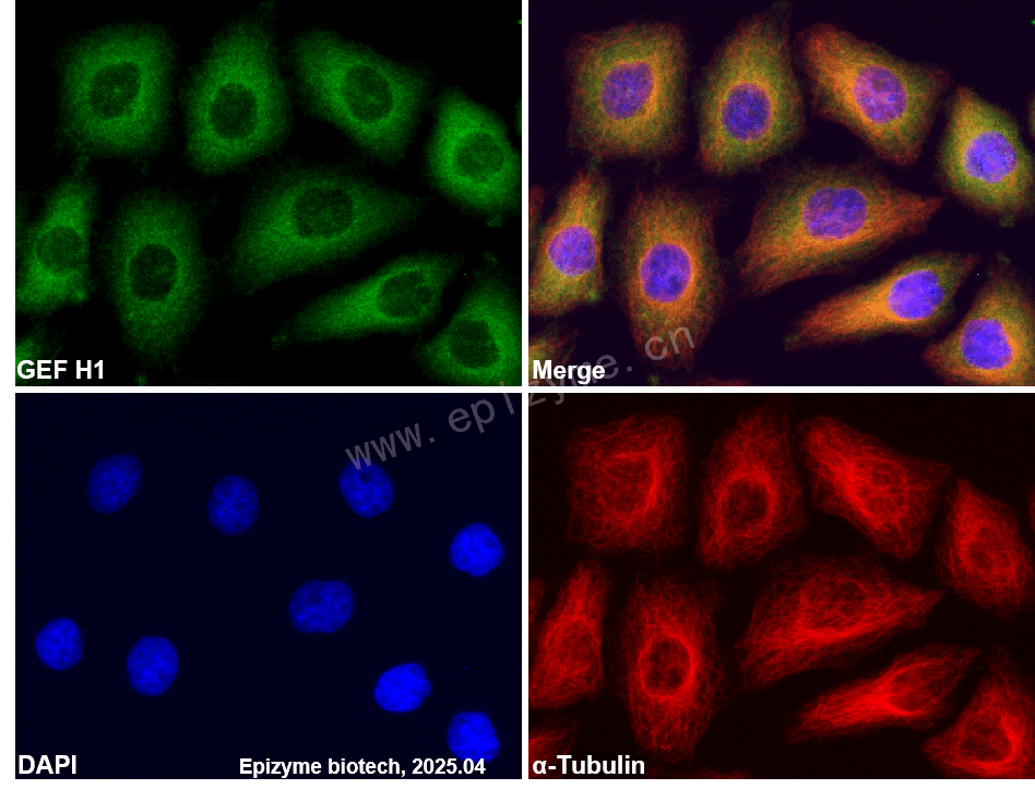 Anti-GEF H1 Rabbit mAb [47L11M49]