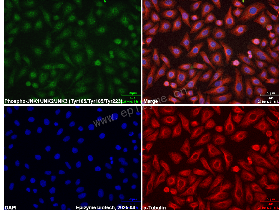 Anti-Phospho-JNK1/2/3 (Tyr185/Tyr185/Tyr223) Rabbit mAb [97D11J71]