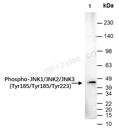 Anti-Phospho-JNK1/2/3 (Tyr185/Tyr185/Tyr223) Rabbit mAb [97D11J71]