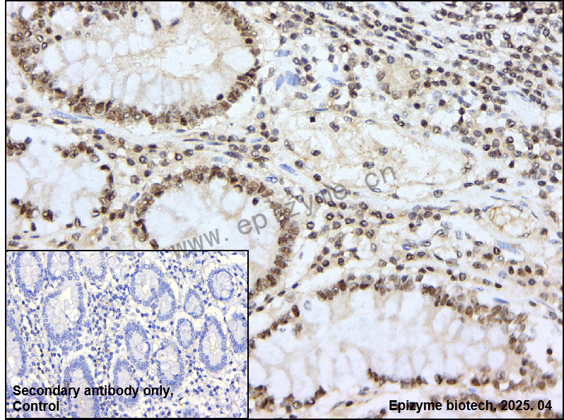 Anti-Phospho-JNK1/2/3 (Tyr185/Tyr185/Tyr223) Rabbit mAb [97D11J71]