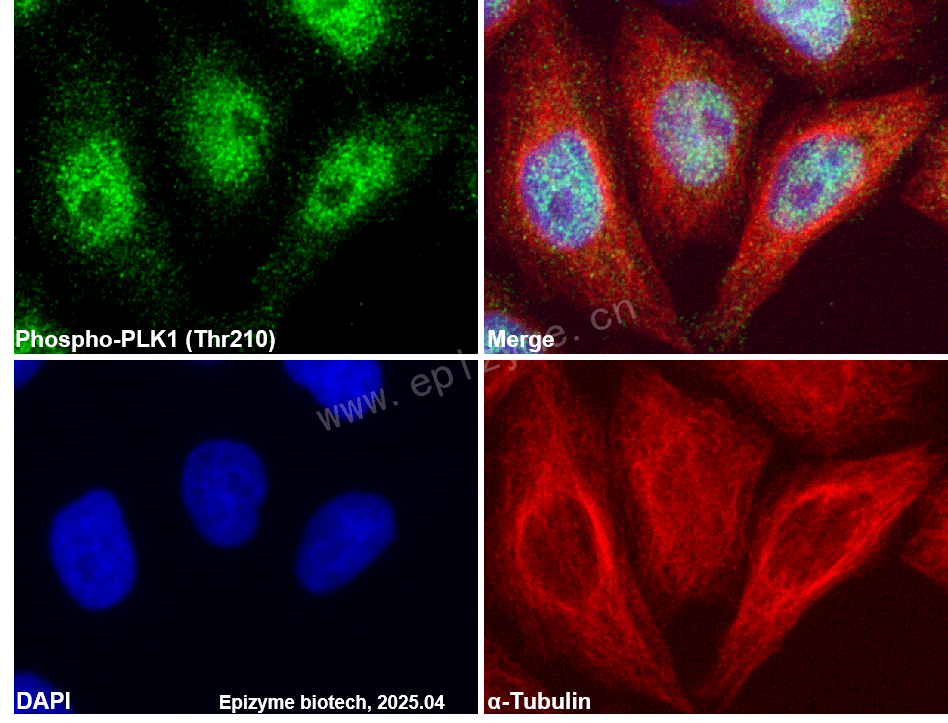 Anti-Phospho-PLK1 (Thr210) Rabbit mAb [87Q55F41]