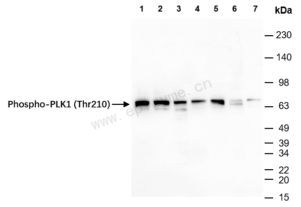 Anti-Phospho-PLK1 (Thr210) Rabbit mAb [87Q55F41]