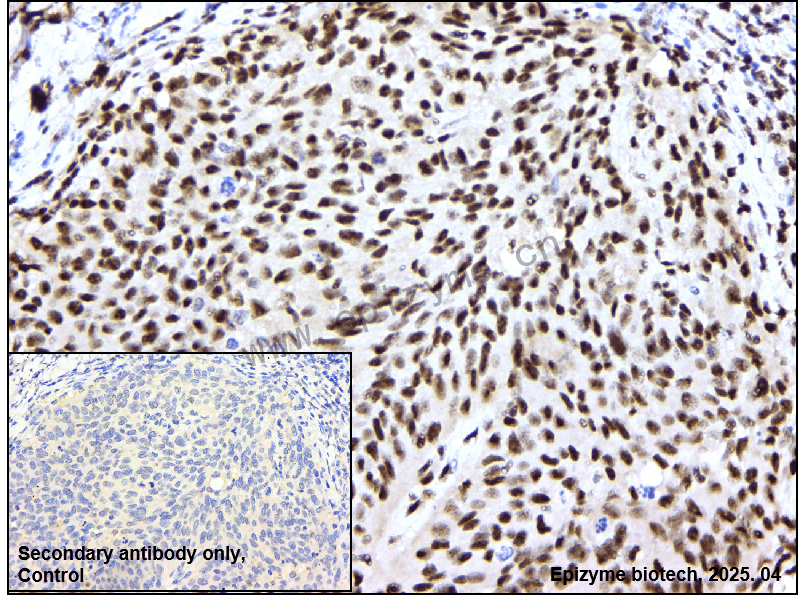 Anti-Phospho-PLK1 (Thr210) Rabbit mAb [87Q55F41]