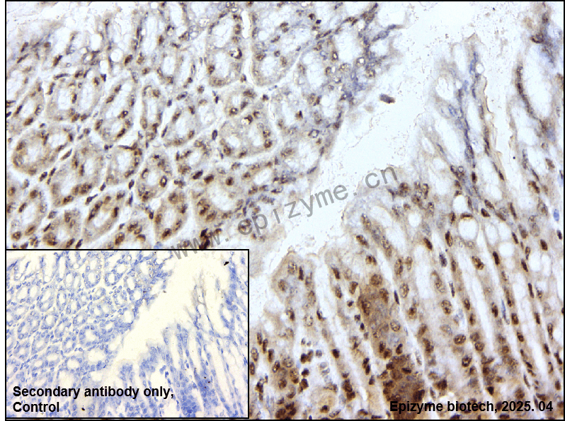 Anti-Phospho-PLK1 (Thr210) Rabbit mAb [87Q55F41]