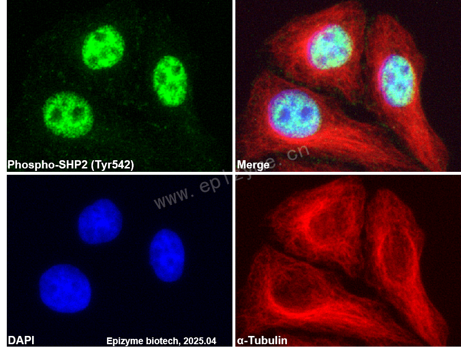 Anti-Phospho-SHP2 (Tyr542) Rabbit mAb [15L32H99]