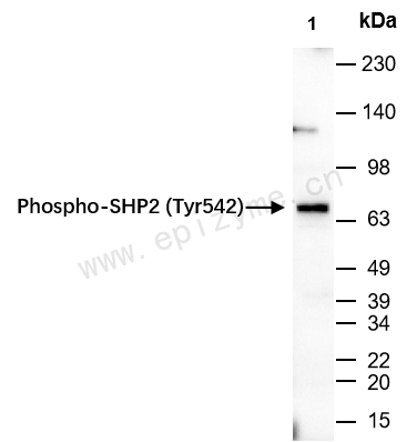Anti-Phospho-SHP2 (Tyr542) Rabbit mAb [15L32H99]