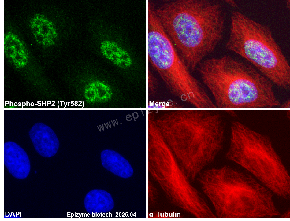Anti-Phospho-SHP2 (Tyr582) Rabbit mAb [60Q04G38]