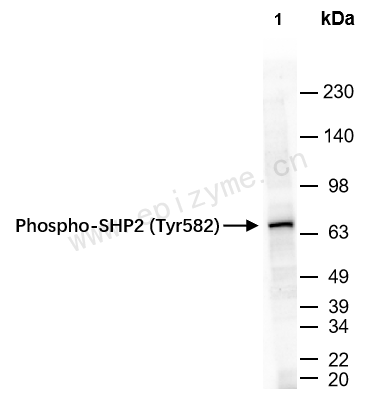 Anti-Phospho-SHP2 (Tyr582) Rabbit mAb [60Q04G38]