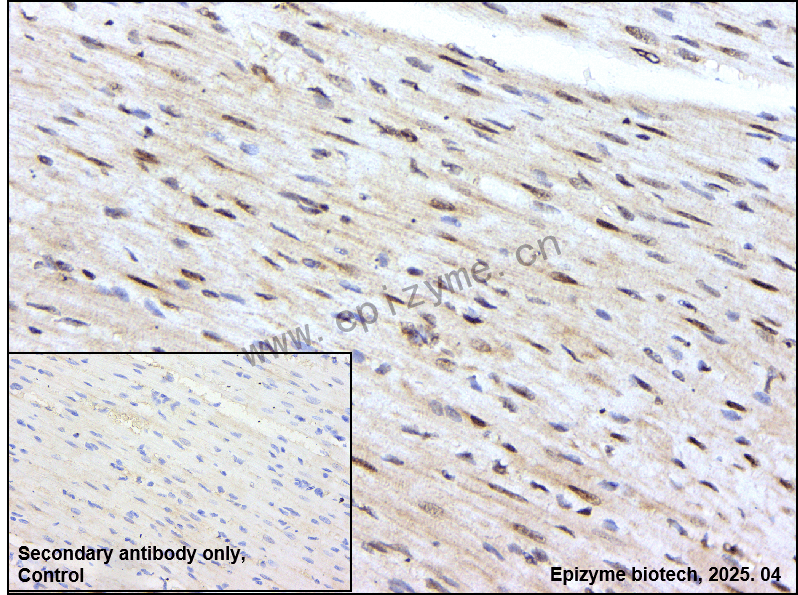 Anti-Phospho-SHP2 (Tyr582) Rabbit mAb [60Q04G38]