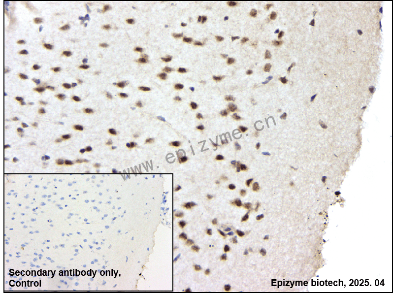 Anti-Phospho-SHP2 (Tyr582) Rabbit mAb [60Q04G38]