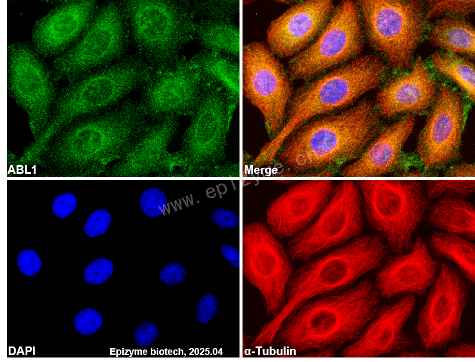 Anti-ABL1 Rabbit mAb [69B20K00]