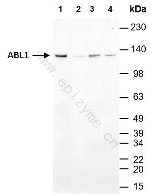 Anti-ABL1 Rabbit mAb [69B20K00]