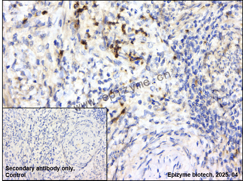 Anti-ABL1 Rabbit mAb [69B20K00]