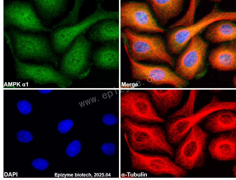 Anti-AMPK alpha 1 Rabbit mAb [69N02G52]