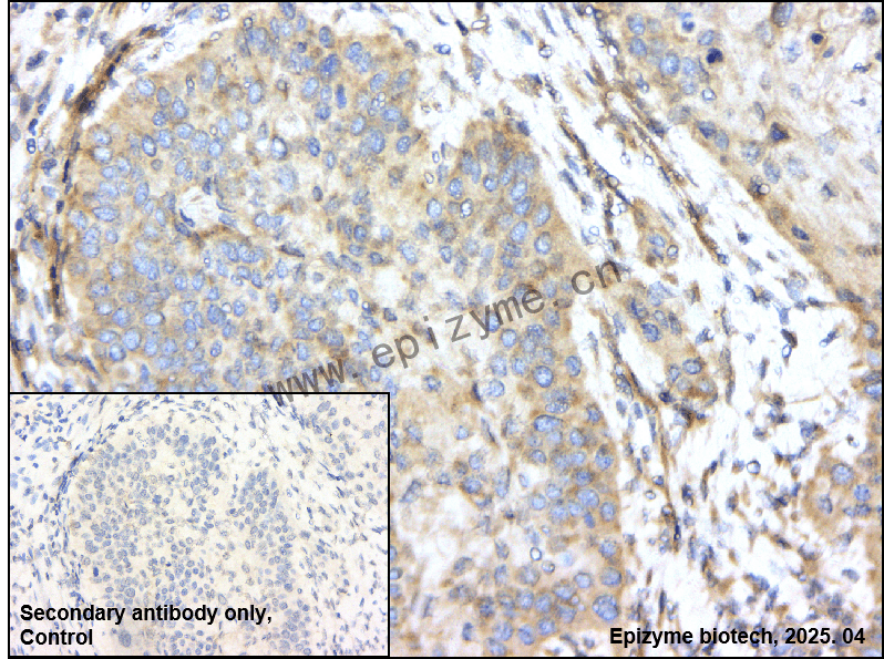 Anti-AMPK alpha 1 Rabbit mAb [69N02G52]