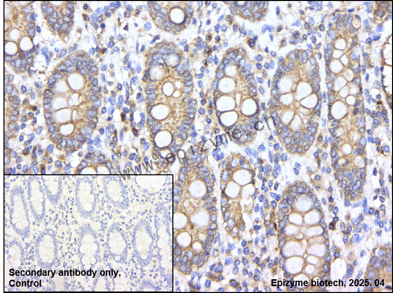 Anti-AMPK alpha 1 Rabbit mAb [69N02G52]