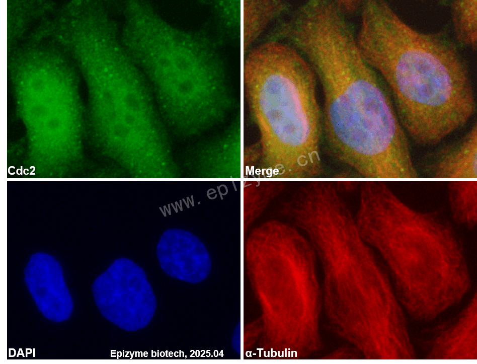 Anti-CDK1 Rabbit mAb [64L56J82]