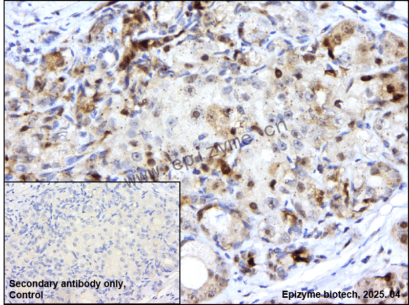 Anti-CDK1 Rabbit mAb [64L56J82]
