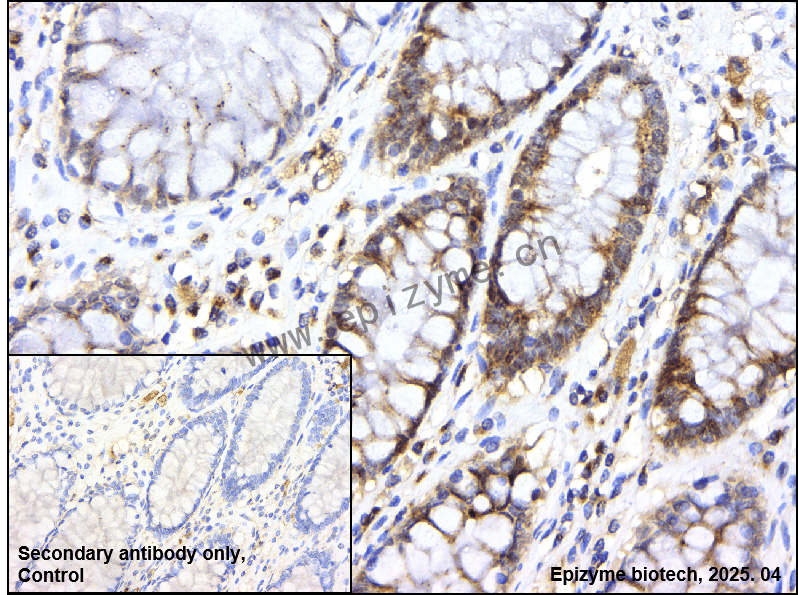 Anti-CDK1 Rabbit mAb [64L56J82]