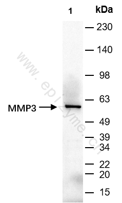 Anti-MMP3 Rabbit mAb [69B98D91]