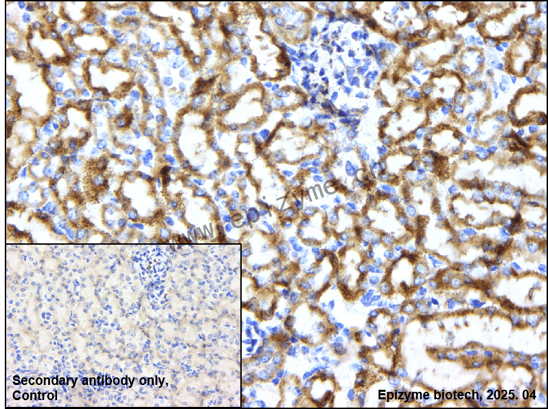 Anti-MMP3 Rabbit mAb [69B98D91]