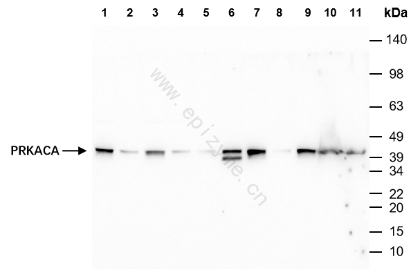 Anti-PRKACA Rabbit mAb [90P12P84]