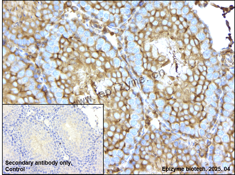 Anti-PRKACA Rabbit mAb [90P12P84]