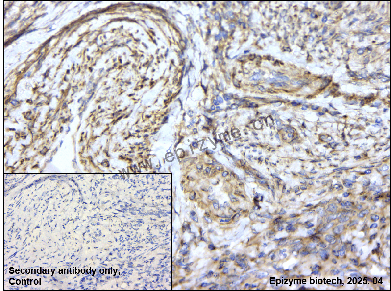 Anti-PRKACA Rabbit mAb [90P12P84]