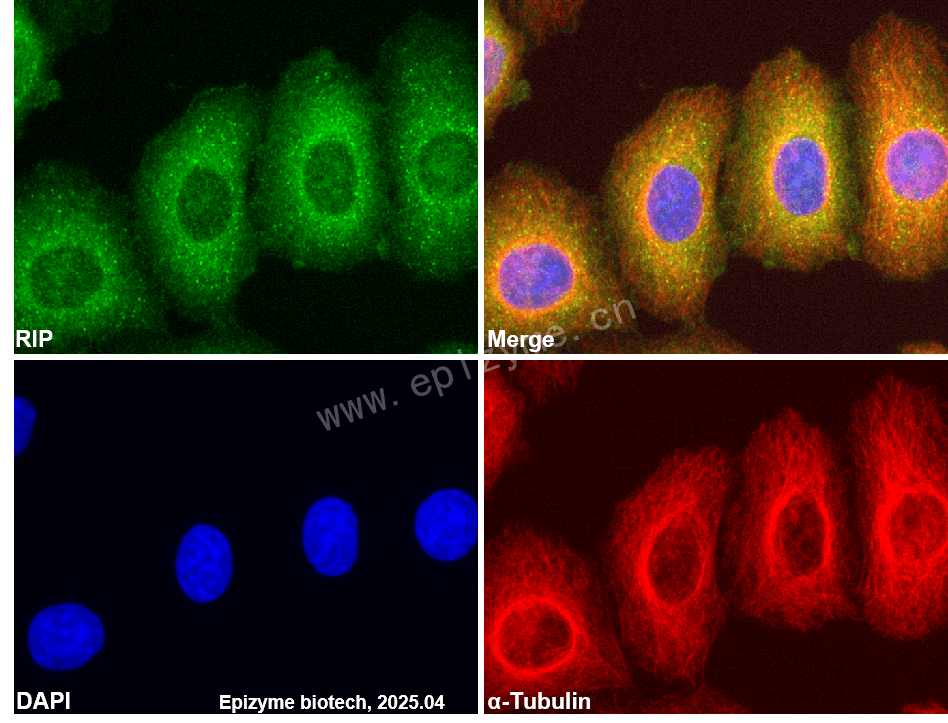Anti-RIP Rabbit mAb [34F06M29]