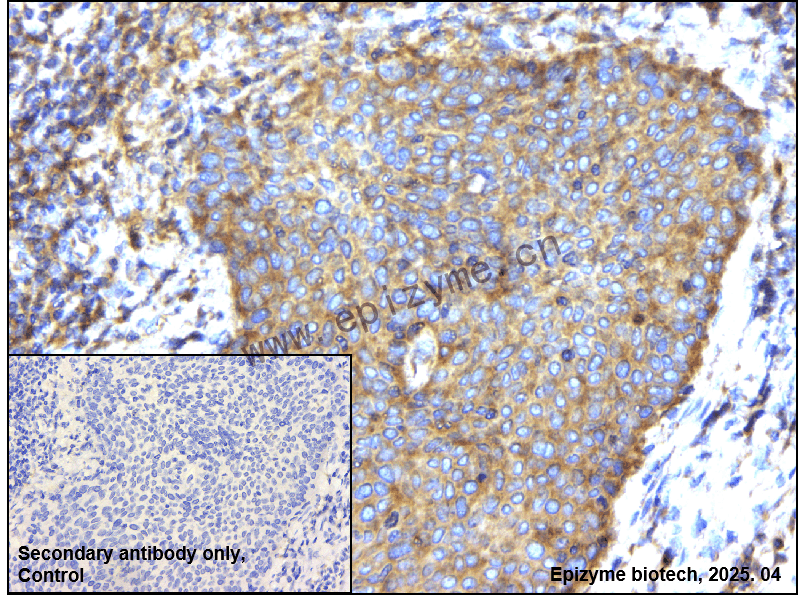 Anti-RIP Rabbit mAb [34F06M29]