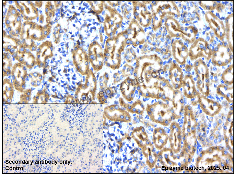 Anti-67kDa Laminin Receptor/RPSA Rabbit mAb [87N39D44]