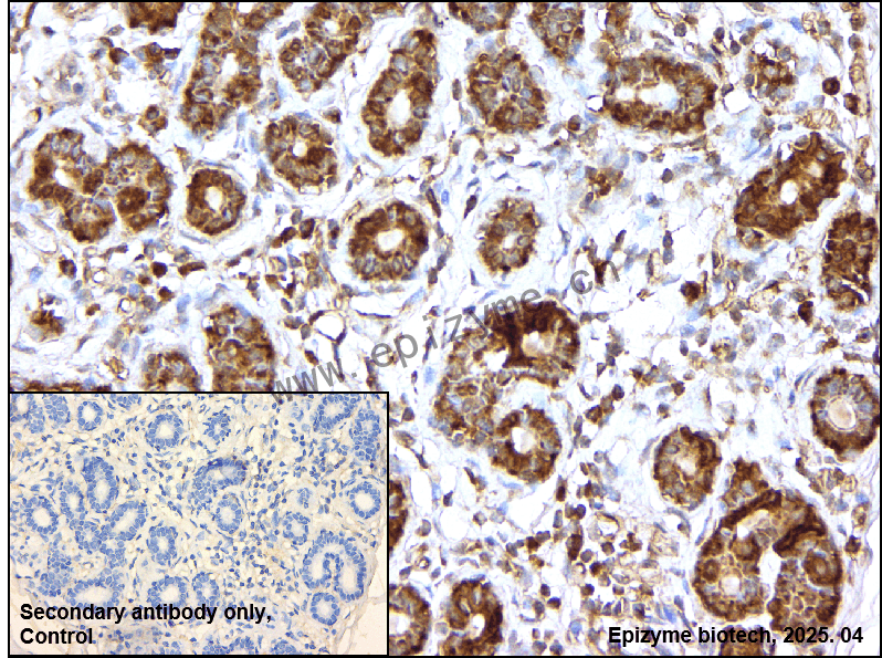 Anti-67kDa Laminin Receptor/RPSA Rabbit mAb [87N39D44]