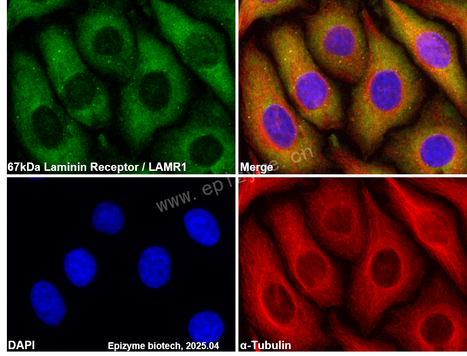 Anti-67kDa Laminin Receptor/RPSA Rabbit mAb [87N39D44]