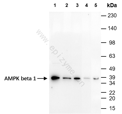 Anti-AMPK beta 1 Rabbit mAb [16F96B80]