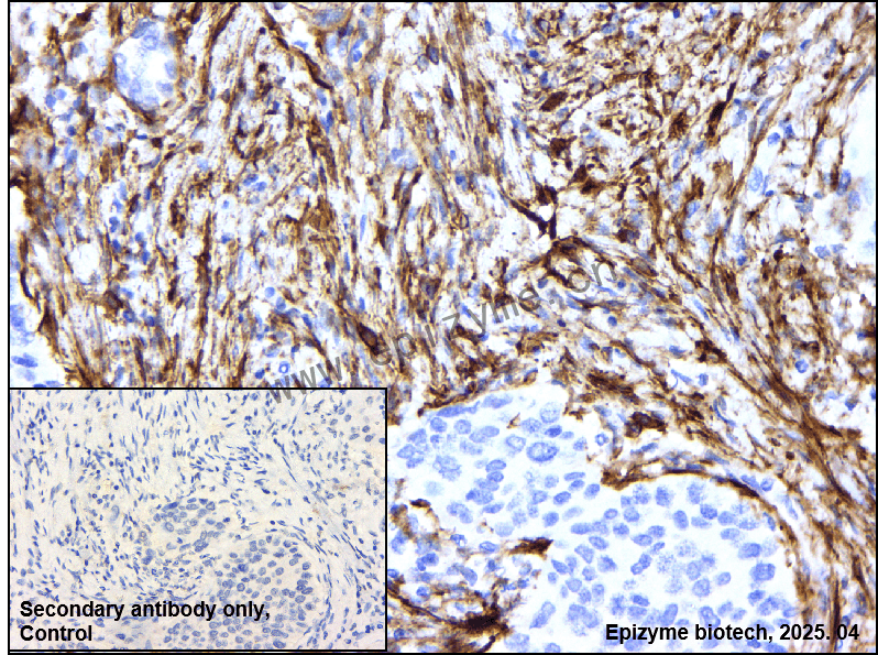 Anti-AMPK beta 1 Rabbit mAb [16F96B80]