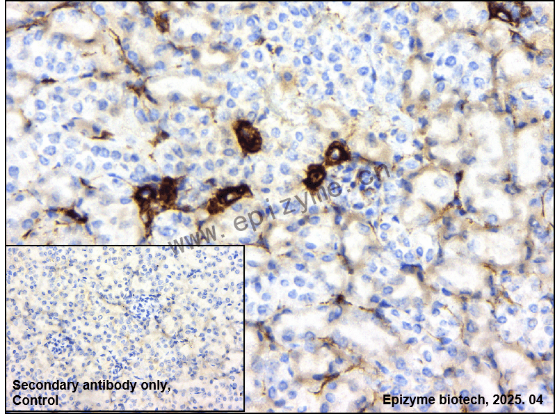 Anti-AMPK beta 1 Rabbit mAb [16F96B80]