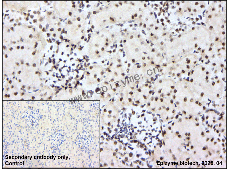 Anti-PIAS1/2 Rabbit mAb [14P26T37]