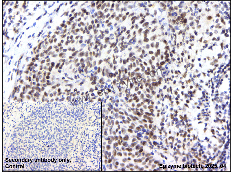 Anti-PIAS1/2 Rabbit mAb [14P26T37]