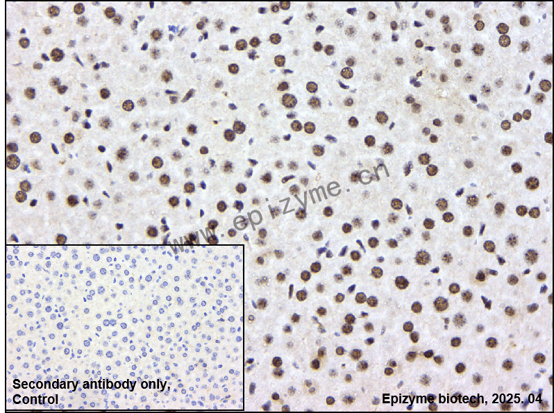 Anti-PIAS1/2 Rabbit mAb [14P26T37]