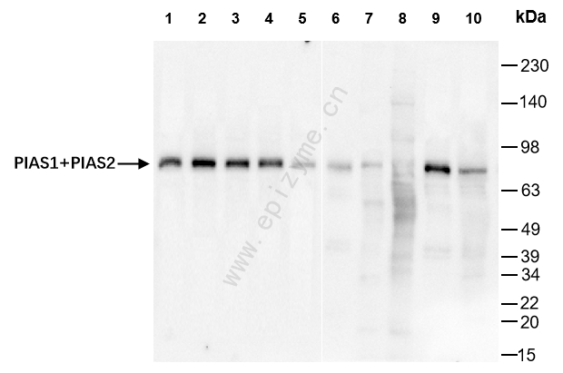 Anti-PIAS1/2 Rabbit mAb [14P26T37]
