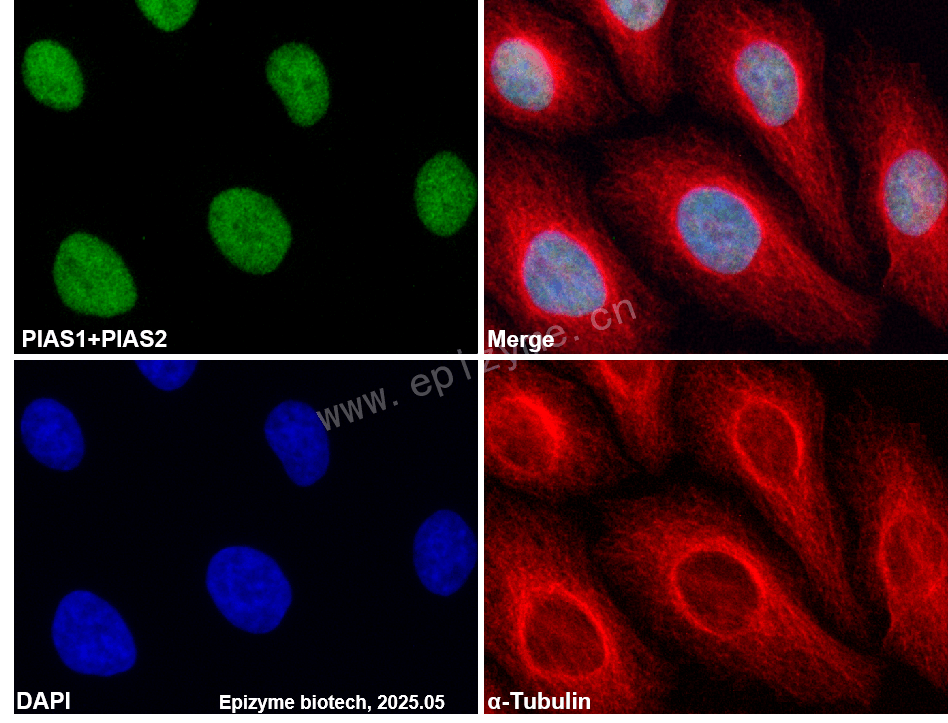 Anti-PIAS1/2 Rabbit mAb [14P26T37]