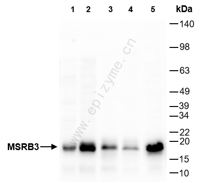 Anti-MSRB3 Rabbit mAb [94M95I97]